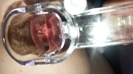 Домашние шалости с гинекологическим зеркалом